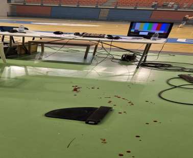 Δημοσιογράφος δέχθηκε καρέκλα στο κεφάλι στο Ομόνοια-ΑΠΟΕΛ - Μεταφέρθηκε στο Νοσοκομείο