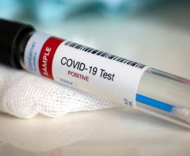 Τα σημεία για rapid test αύριο