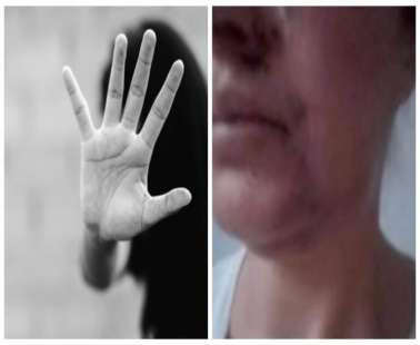 Λεμεσός: Γρονθοκόπησαν Ρωσίδα και την ανάγκασαν να φωνάξει συνθήματα για την Ουκρανία