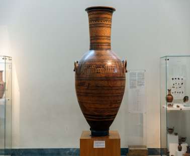 Η τέχνη της αγγειογραφίας