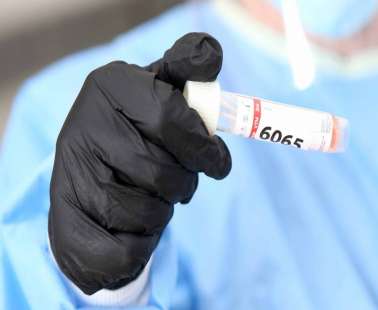 Τα νέα σημεία δειγματοληψίας για rapid test
