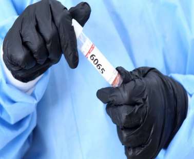 152 νέα κρούσματα - 11 από rapid tests