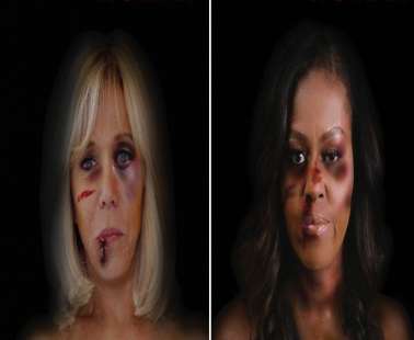 Μπριζίτ Μακρόν και Μισέλ Ομπάμα με μώλωπες στο πρόσωπο