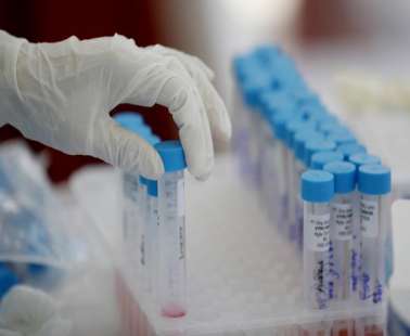 rapid test αύριο Δευτέρα