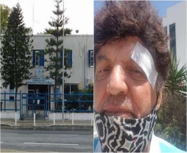Tον ενόχλησε το μηχάνημα και ξυλοφόρτωσε εθελοντή