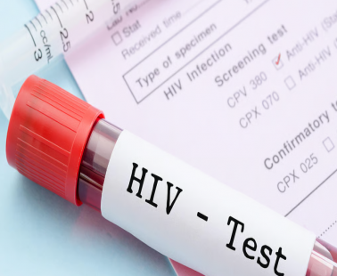 Σημαντική πρόοδος στη μάχη ενάντια στον HIV