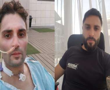 «Κάηκε όλο μου το σώμα…Φώναζα με όση δύναμη μου είχε απομείνει