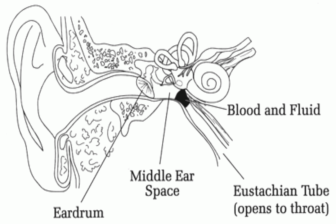 Equalization 