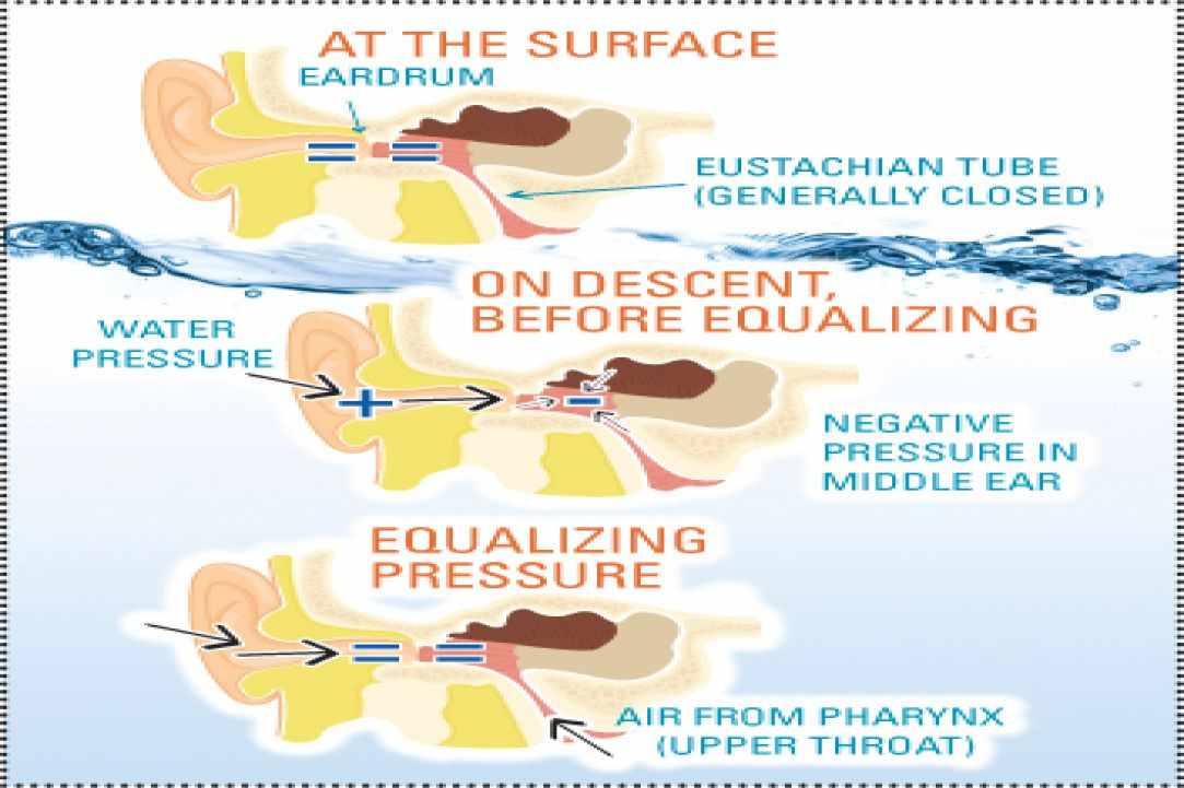 Equalization 