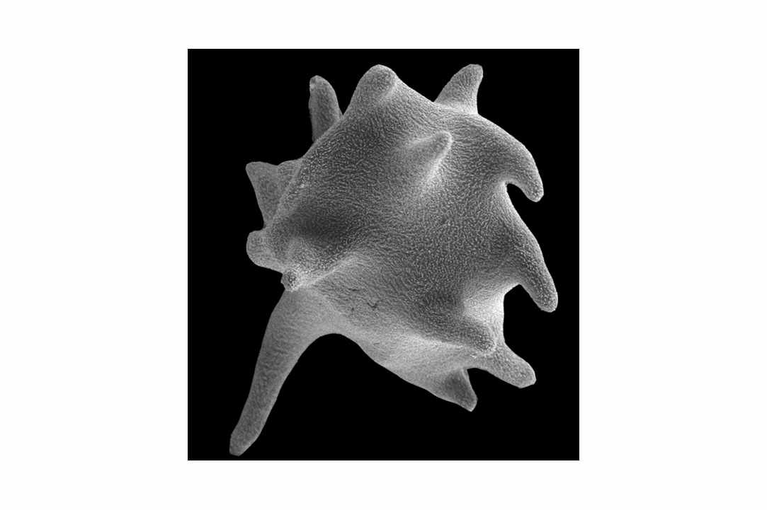 "Little Monsters" - Life under the microscope