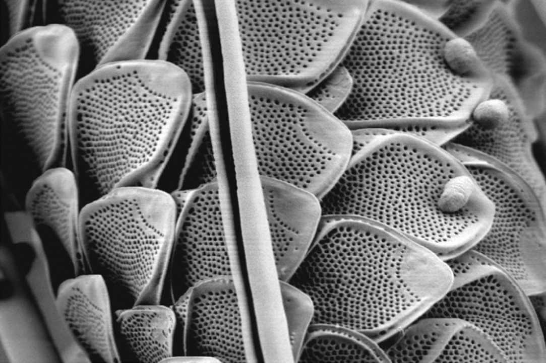 "Little Monsters" - Life under the microscope