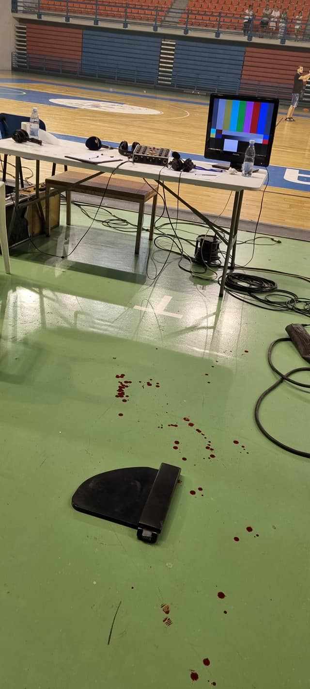 Δημοσιογράφος δέχθηκε καρέκλα στο κεφάλι στο Ομόνοια-ΑΠΟΕΛ - Μεταφέρθηκε στο Νοσοκομείο