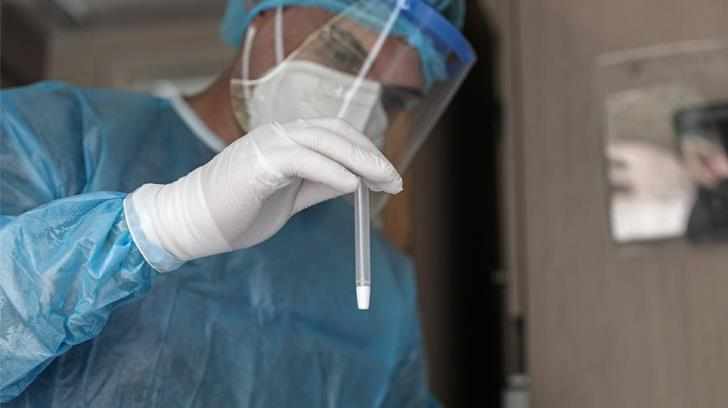 Πώς απαντά ο ΟΚΥπΥ για τις ελλείψεις PCR test