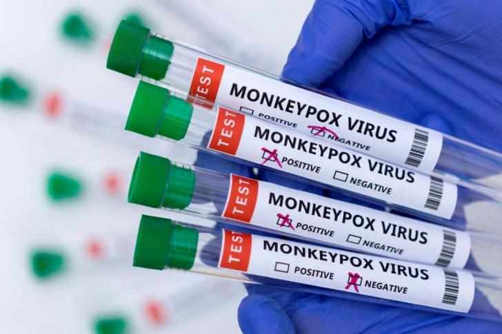 Εντοπίστηκε το πρώτο κρούσμα ευλογιάς των πιθήκων στην Κύπρο