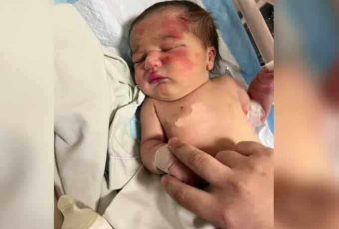 Αδέσποτος σκύλος έσωσε μωρό που είχαν πετάξει στα σκουπίδια μέσα σε σακούλα