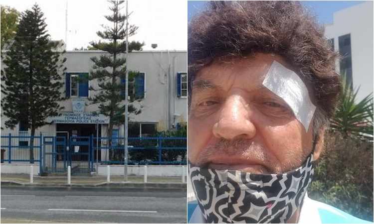 Tον ενόχλησε το μηχάνημα και ξυλοφόρτωσε εθελοντή