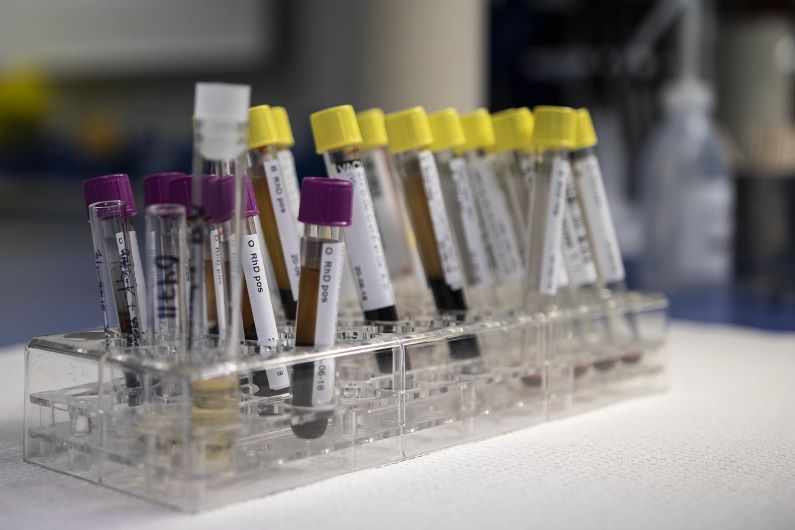 Νέα σημεία για τις μονάδες δειγματοληψίας για rapid tests την Παρασκευή