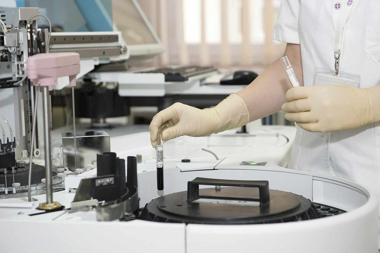 Έναρξη προγράμματος «Cy Checkpoint: PopUp HIV Test»