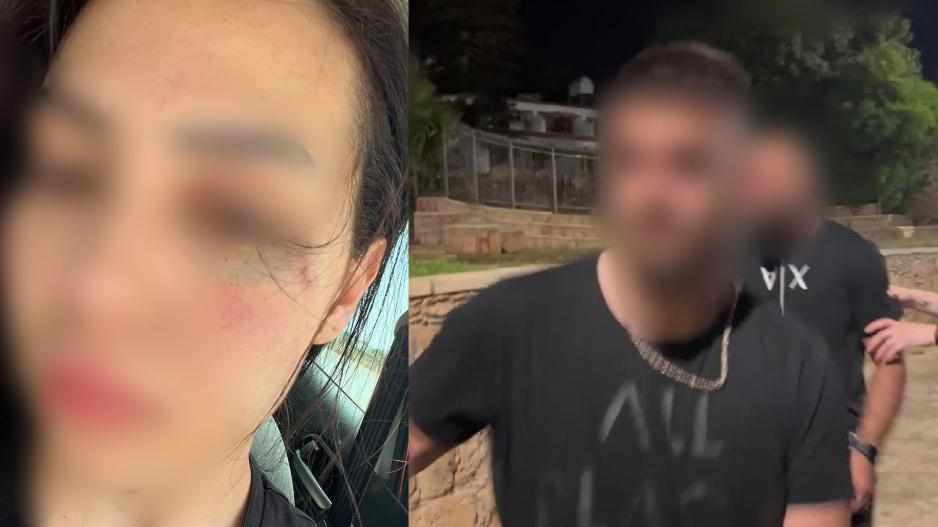 Ξυλοκόπησαν 25χρονη Τουρκοκύπρια στην Αγία Νάπα