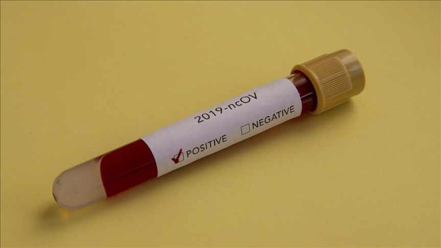 Τα σημεία για rapid test σε εργαζόμενους