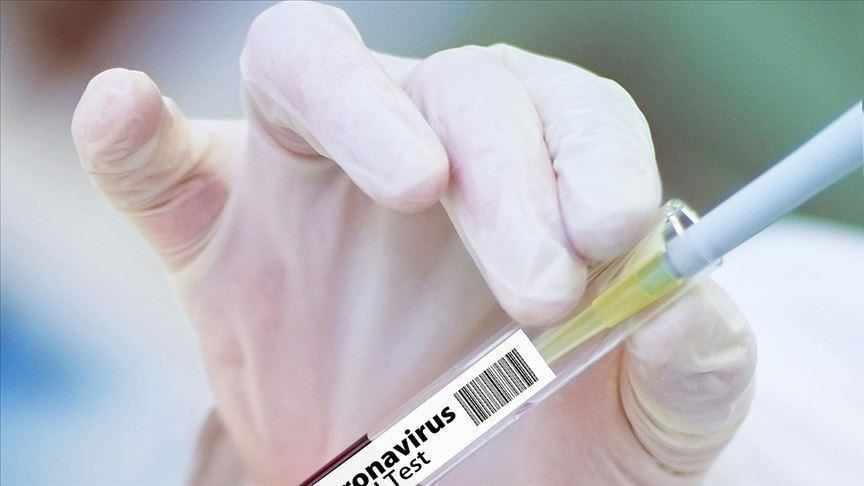 Χρέωσαν 400.000 ευρώ για μοριακά τεστ που δεν έκαναν